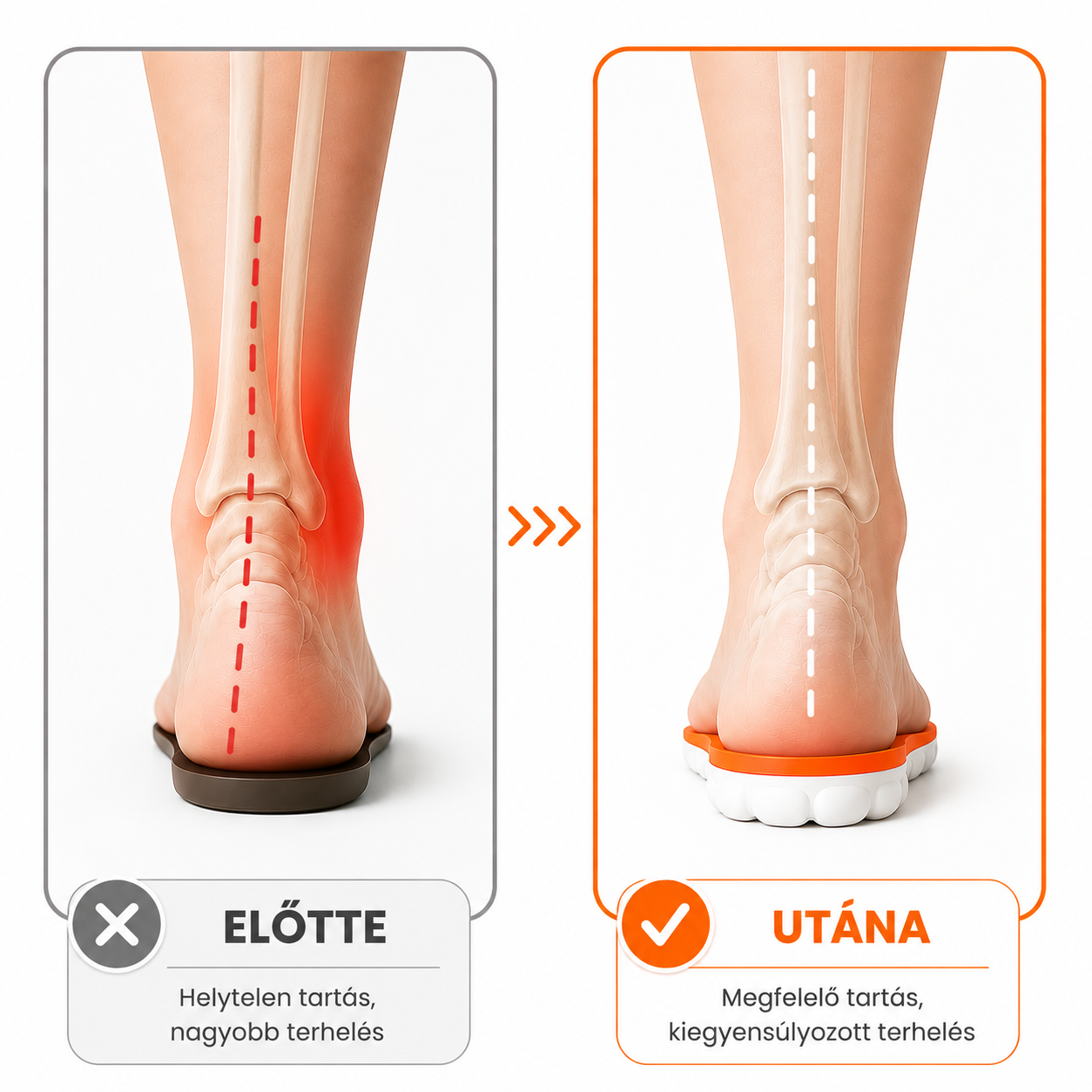 VitalTalp - Comfort memóriahabos masszázstalpbetét